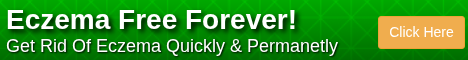 Eczema